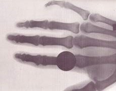 Hand X-ray